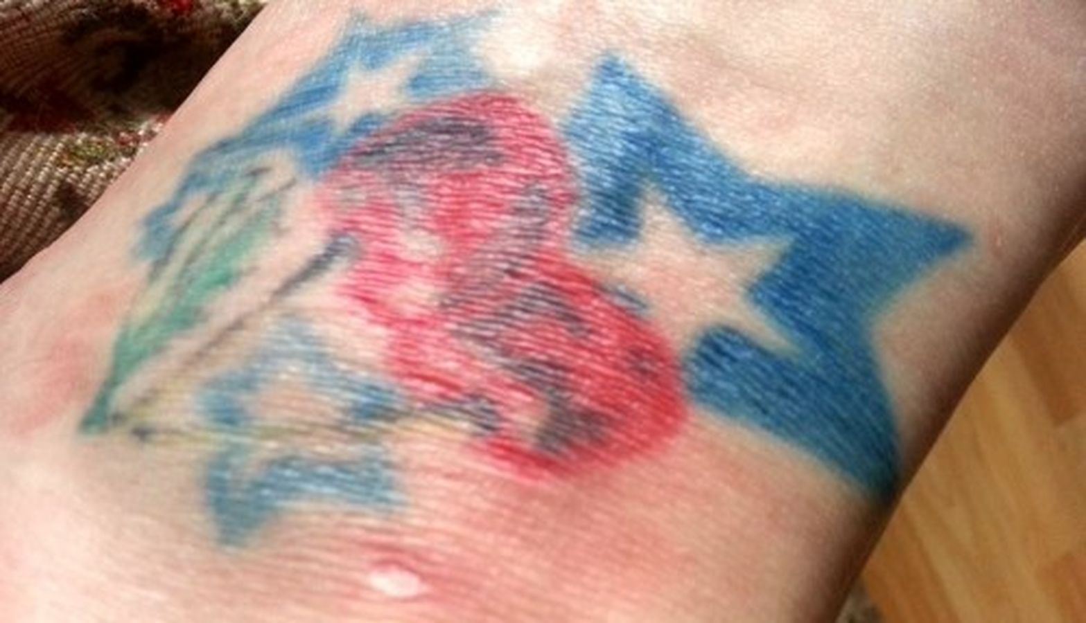 Kirsche-trifft-auf-nichts-sagende-blaue-Sterne