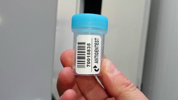 Speicheltestbecher vor der Scheune